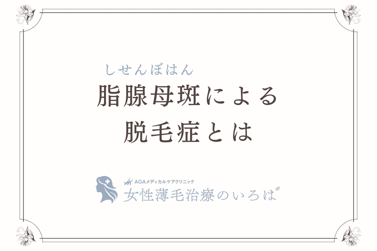 脂腺母斑（しせんぼはん）による脱毛症とは