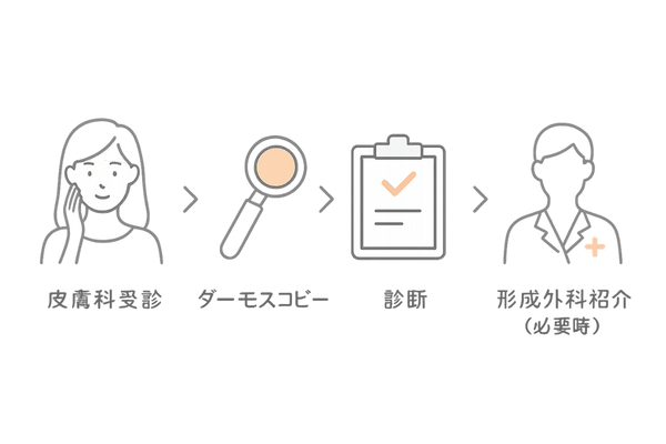 脂腺母斑診断フローチャート（皮膚科→形成外科）