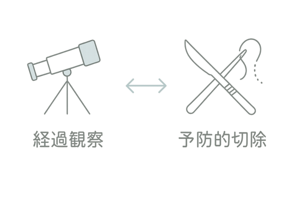 経過観察と切除手術の選択肢比較イラスト