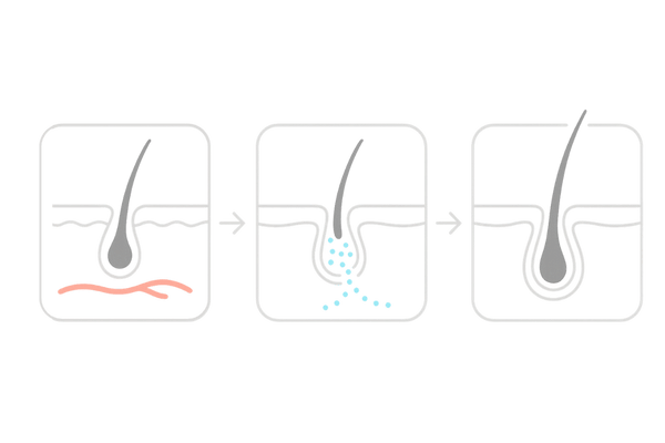 ミノキシジル内服薬の作用メカニズム｜血流促進とヘアサイクル正常化の3ステップ図解（女性の薄毛治療）