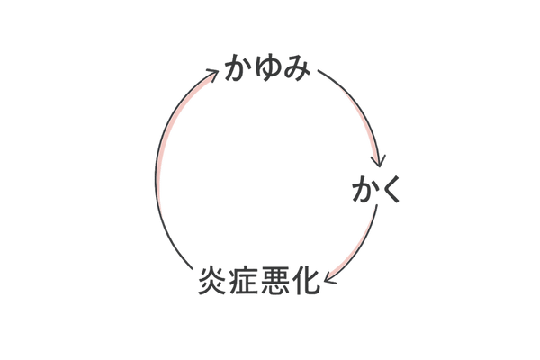 かゆみと炎症がループする悪循環フロー図