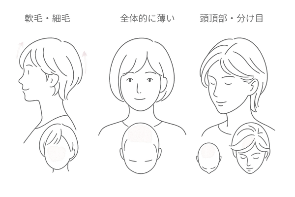 髪質・薄毛タイプ別おすすめショートヘア｜軟毛・全体薄毛・頭頂部/分け目カバー