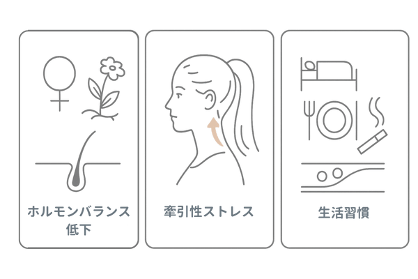 女性のM字はげの主な原因マップ(ホルモン・牽引・生活習慣)