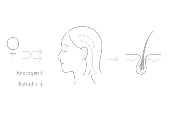 女性の生え際が薄くなる原因の可視化｜ホルモン・血行・頭皮環境のメカニズム図