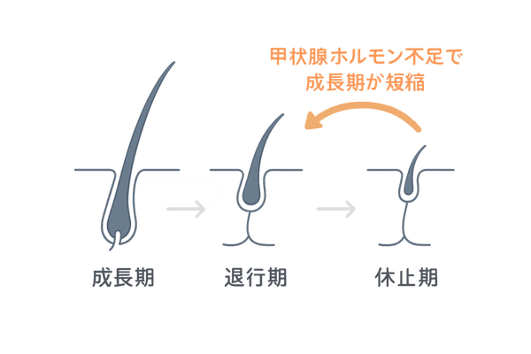 ヘアサイクルと休止期脱毛のメカニズム図