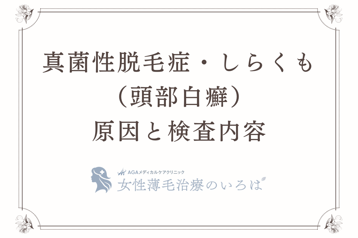 真菌性脱毛症・しらくも（頭部白癬）の原因と検査内容