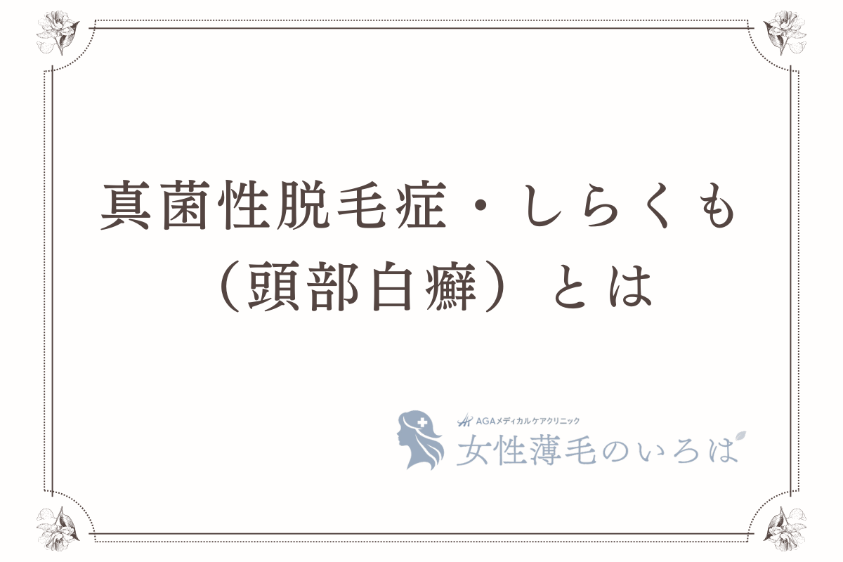 真菌性脱毛症・しらくも（頭部白癬）とは