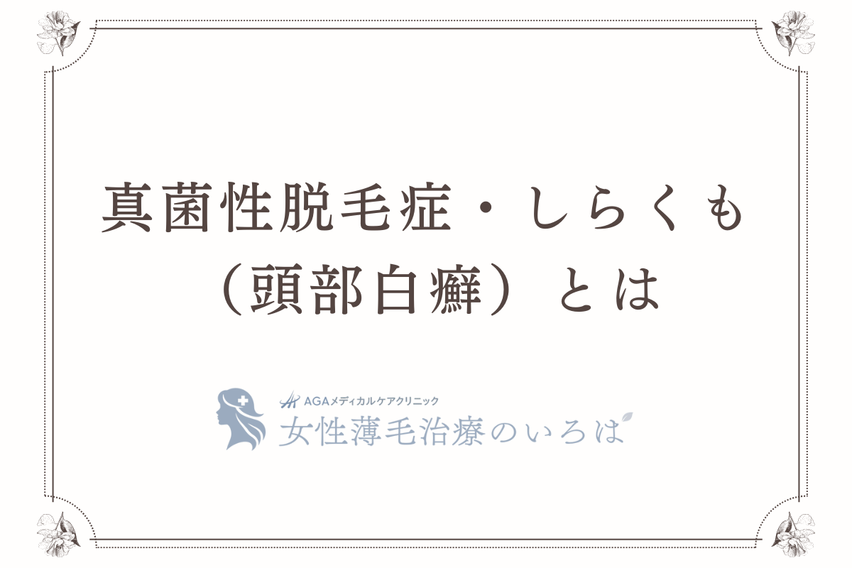 真菌性脱毛症・しらくも（頭部白癬）とは