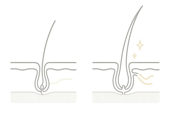 ミノキシジル内服の作用機序|血流改善で成長期を延長し太く育てる