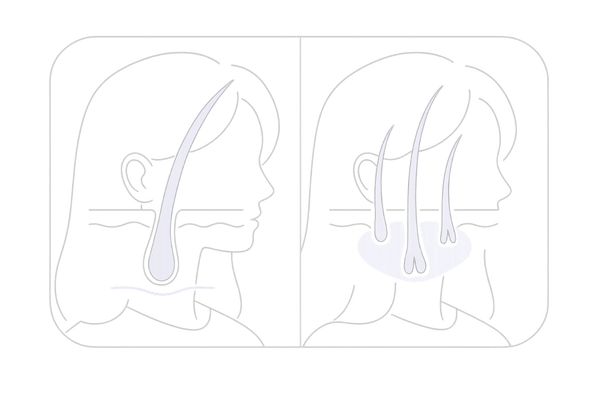 女性の育毛と発毛の違いを図解|既存毛の強化と新生毛の増加のビジュアル比較
