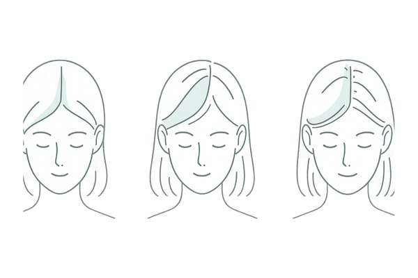 女性の薄毛の初期サイン｜分け目の広がりとボリューム低下の段階比較（イラスト）