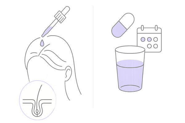 女性向け抜け毛防止薬の種類比較（外用ミノキシジルと内服スピロノラクトンのイメージ）