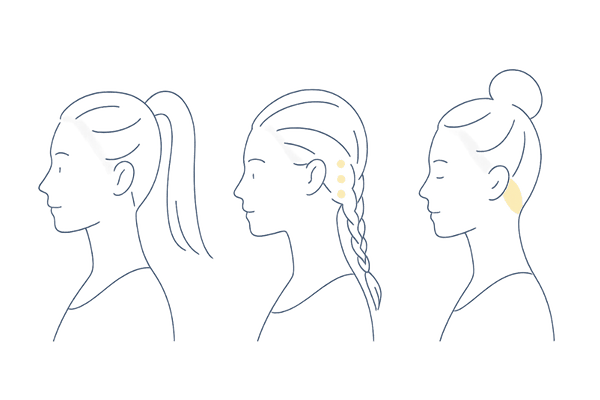 牽引性脱毛症を招きやすい髪型と生え際への負担｜女性のおでこが広く見える原因