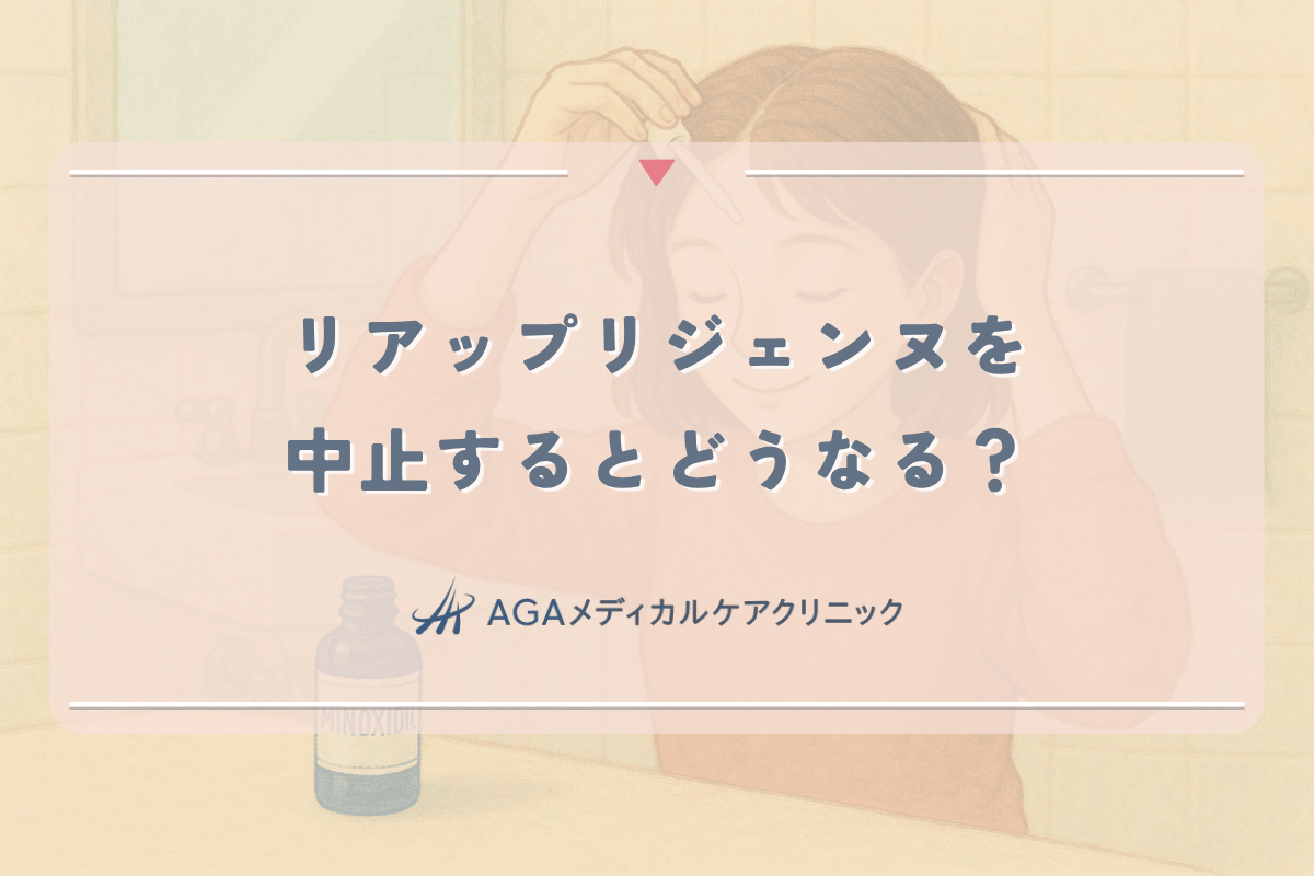 リアップリジェンヌを中止するとどうなるのか？薄毛再発リスクと対策法