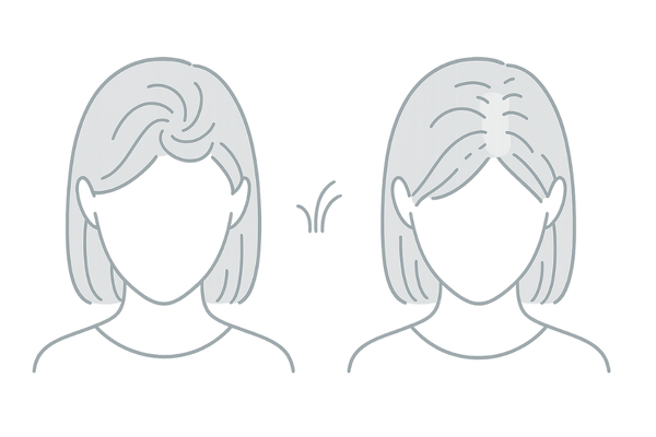 大学生女性の正常なつむじと薄毛の兆候の違い|頭頂部の左右比較イラスト