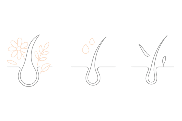 産後のエストロゲン低下とヘアサイクル変化|分娩後脱毛症イラスト