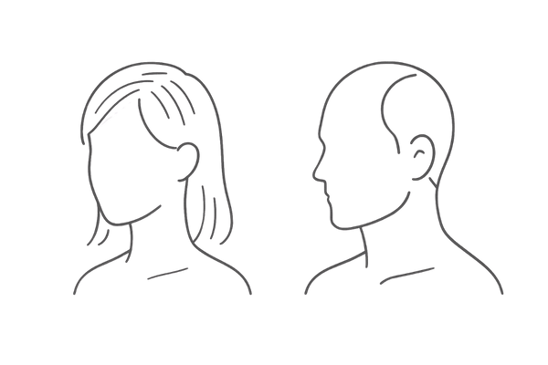 FAGAと男性AGAの進行パターン比較|女性はびまん性・男性はM字O字の違い
