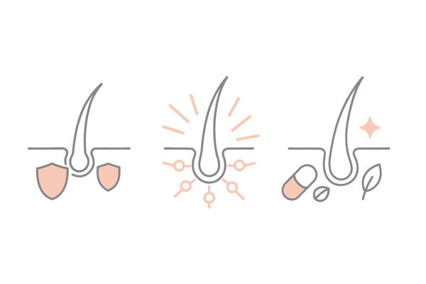 女性の薄毛治療薬の作用イメージ|スピロノラクトン・ミノキシジル・栄養サポートの比較