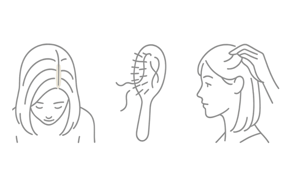 30代女性の薄毛初期サイン｜分け目の地肌透け・抜け毛増加・ボリューム低下のイメージ