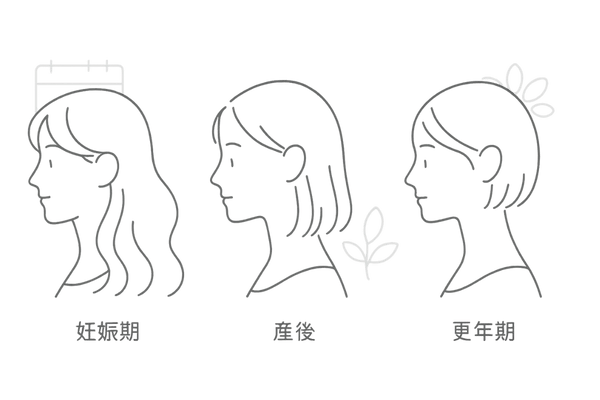 女性ホルモンと髪の変化|妊娠期・産後・更年期のボリューム推移を示すミニマル図