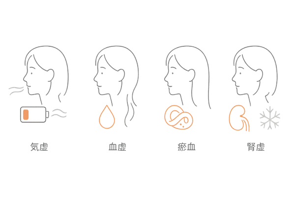 女性の薄毛の体質タイプ（気虚・血虚・瘀血・腎虚）アイコン図