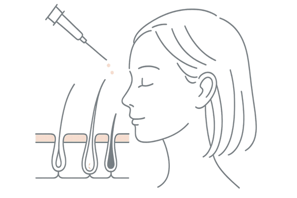 女性の薄毛治療メソセラピーの仕組み|頭皮に成分を直接注入するイメージ図
