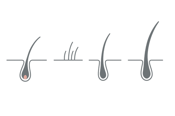 初期脱毛と経過の理解｜使用開始から6か月の髪の変化を4段階で示す線画