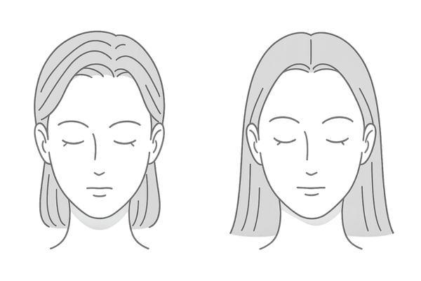 女性の生まれつきM字生え際と富士額の違い｜正面比較イラスト
