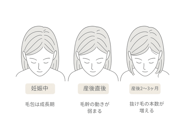 産後抜け毛の仕組み|妊娠中〜産後のホルモン変化とヘアサイクル図解