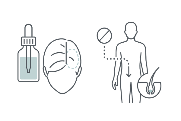 飲むミノキシジルと外用薬の違いをひと目で比較(女性のFAGA治療)