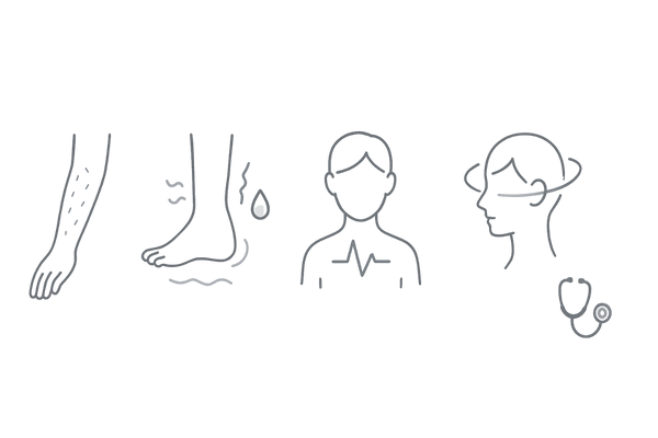 飲むミノキシジルの主な副作用アイコン(多毛・むくみ・動悸・めまい)