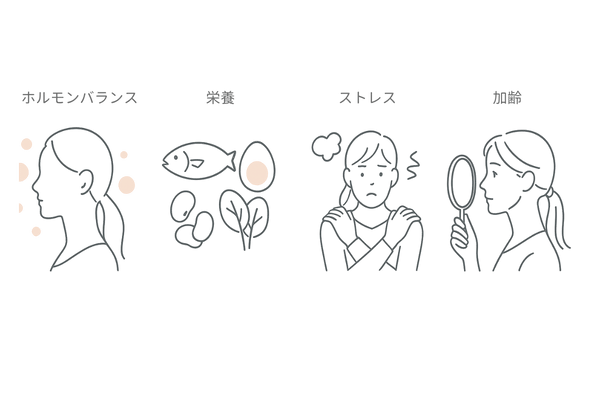 女性の抜け毛の主な原因|ホルモンバランス・栄養不足・ストレス・加齢のアイコン図解