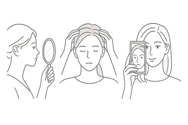 女性のおでこが広く感じるサイン｜鏡・髪型・自撮りで気づく生え際の変化