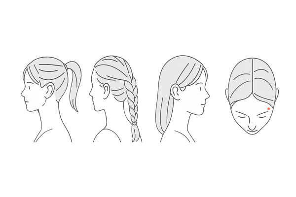 牽引性脱毛症の原因ヘアスタイル例｜きつい結び・三つ編み・エクステ・同じ分け目