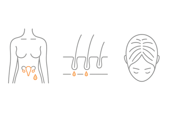 更年期のエストロゲン低下と髪の変化のメカニズム図(3カラム)