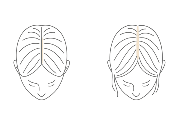 更年期に多いびまん性脱毛のサイン:分け目の比較(左右2カラム)
