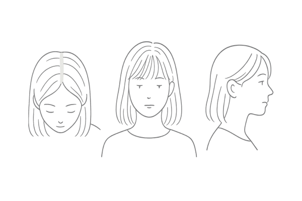 女性の前髪薄毛 初期サインの例（分け目の透け・細毛/産毛・ボリューム低下）セルフチェック用イメージ