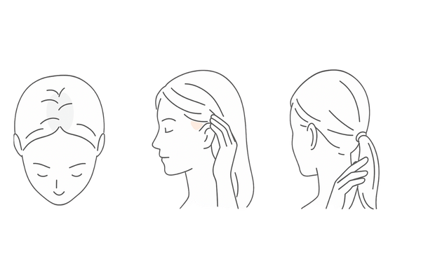 女性のこめかみ薄毛の初期サイン|分け目拡大・こめかみの透け感・毛束ボリューム低下