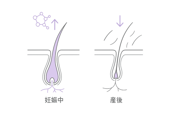 産後の抜け毛の原因:ホルモン低下と毛周期の変化イメージ