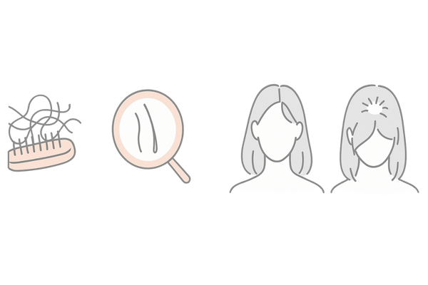 受診を検討すべきサイン｜抜け毛増加・髪の細化・分け目拡大・頭頂部の透け