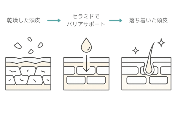 キュレル頭皮保湿ローションの役割｜乾燥→バリア低下→整える3カラム概念図