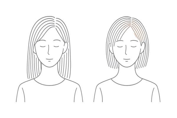 女性の薄毛の特徴(生え際後退より“全体が細くなる”)