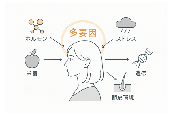 原因は人それぞれ(多要因モデル:ホルモン・ストレス・栄養・頭皮環境・遺伝)