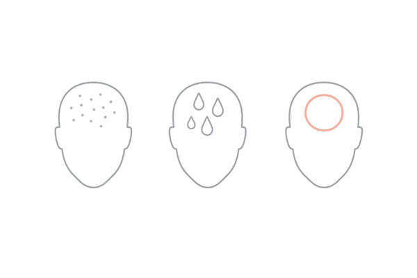 乾燥・脂性・敏感の頭皮タイプ別ケア指針イメージ