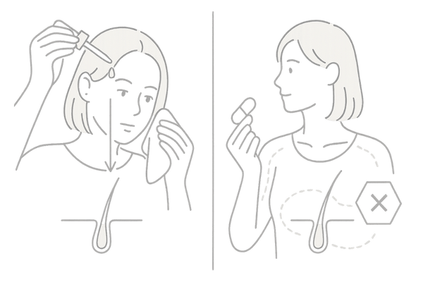 ミノキシジル外用とスピロノラクトン内服の違い｜女性薄毛治療の比較イラスト