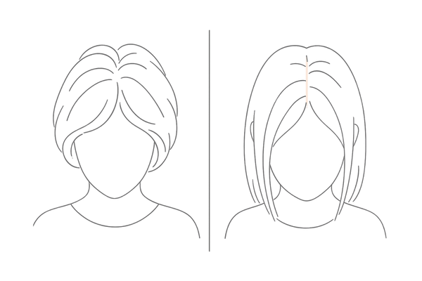 細毛化で分け目が広がる女性の頭頂部イメージ