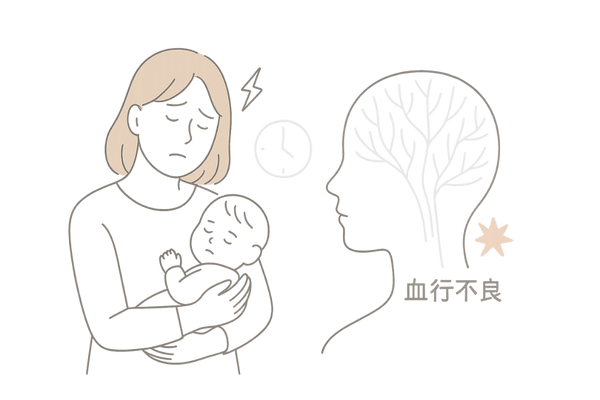 ストレスと睡眠不足が頭皮の血行を悪くするイメージ