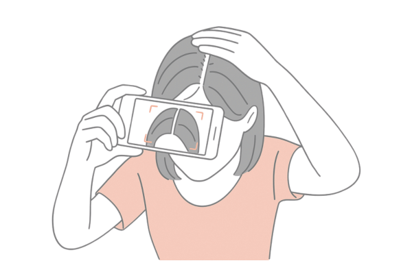 分け目の幅が広がる初期薄毛サインをスマホで記録する女性のイメージ