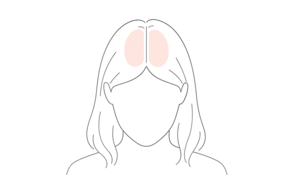 分け目まわりで地肌が透ける範囲をチェックするイメージ図
