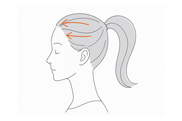 強いポニーテールやきつい結び目が分け目に負担をかける牽引性脱毛のイメージ